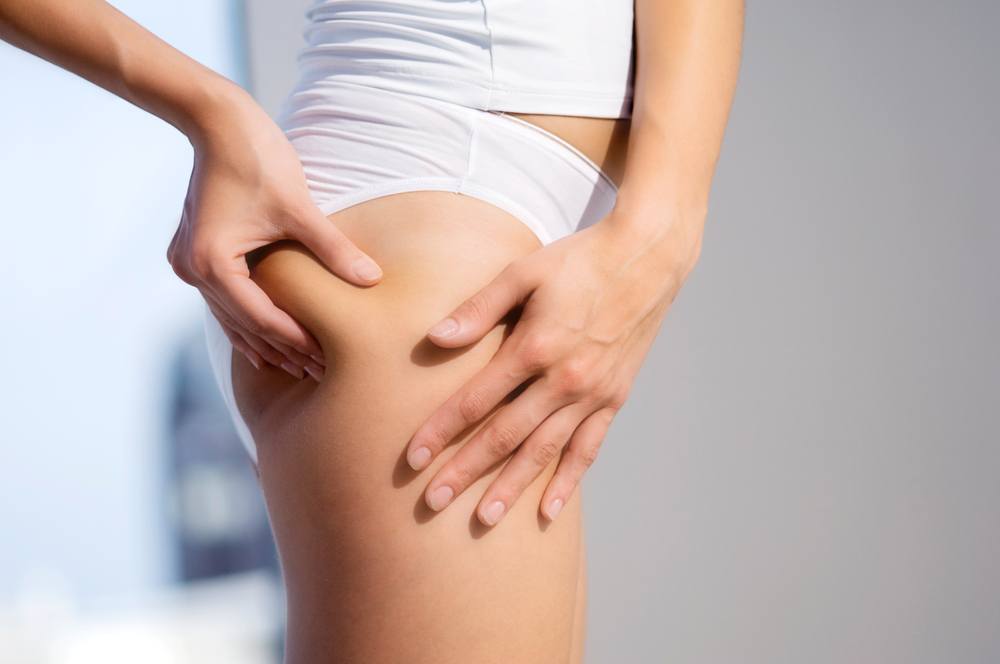 cellulite