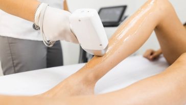 Épilation laser des jambes