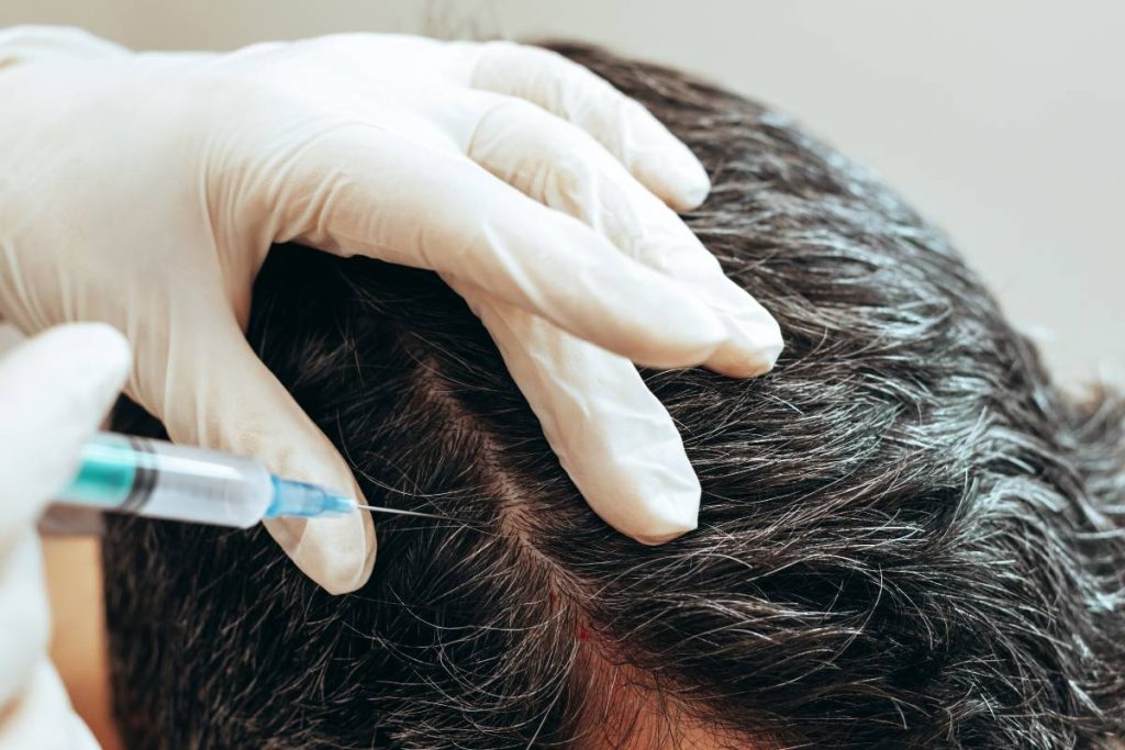 homme soins greffe de cheveux 