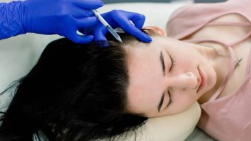 patiente détendue pendant une opération de greffe de cheveux