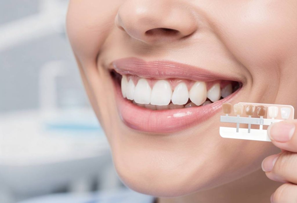 testeur blancheur de dents